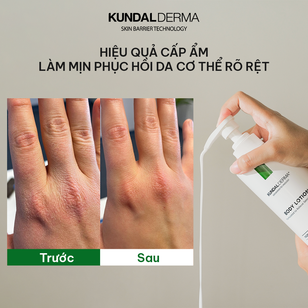 Kem dưỡng thể cấp ẩm và phục hồi da KUNDAL Derma C.P.R. CICA & TEA TREE REPAIR BODY LOTION