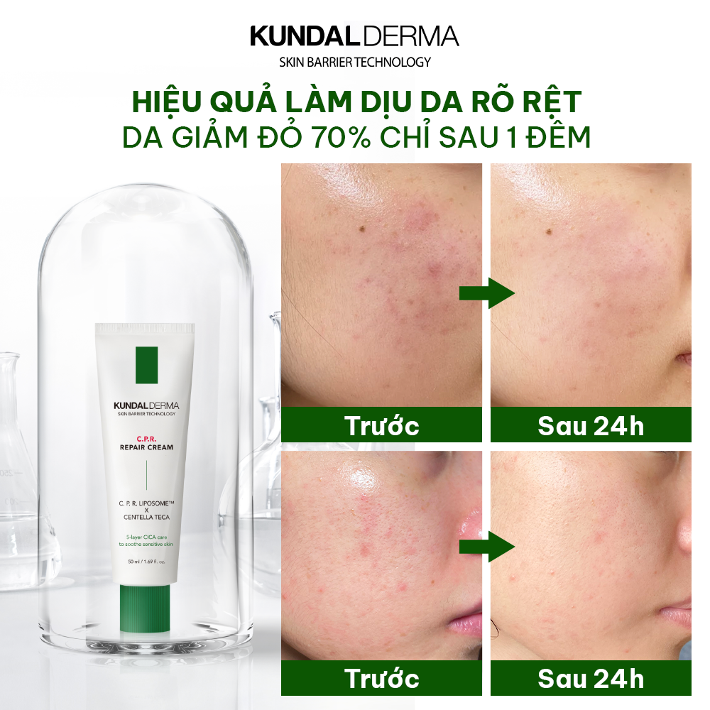 Kem Dưỡng Cấp Ẩm Phục Hồi Chuyên Sâu KUNDAL DERMA C.P.R. CICA BALM REPAIR CREAM 50ml