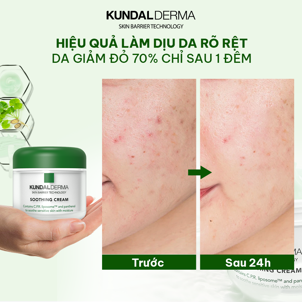 Kem Dưỡng Cấp Ẩm Làm Dịu Da KUNDAL DERMA C.P.R. CICA SOOTHING CREAM 50ml